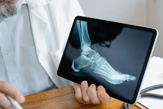 X-Ray (2)